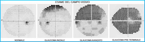 Esame visivo di un biscotto per individuare segni di usura