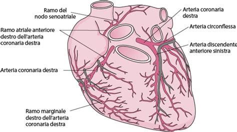 Illustrazione delle arterie coronarie ostruite