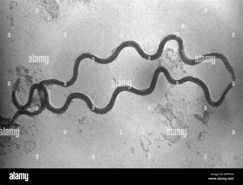 Micrografia del batterio Treponema pallidum