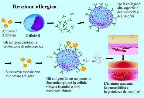 Diagramma della reazione allergica