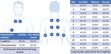 Confronto dati auscultazione LungPass e pneumologo per pazienti COVID-19