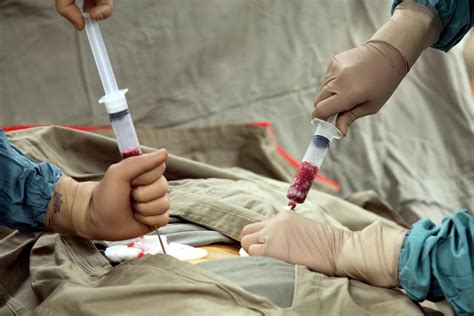 Immagine di un medico che preleva midollo osseo dal bacino di un donatore