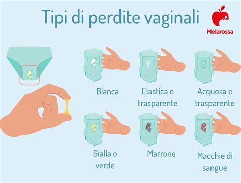 Diagramma delle cause di perdite vaginali anomale