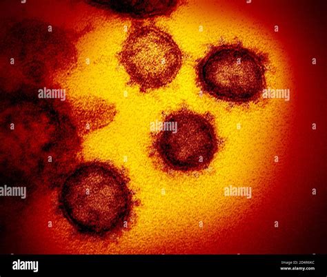 Microscopio che mostra il virus SARS-CoV-2 e bambini che giocano