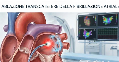 Schema illustrativo della procedura di ablazione ibrida transcatetere
