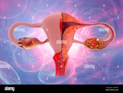 Anatomia dell'utero con evidenziate le pareti interne