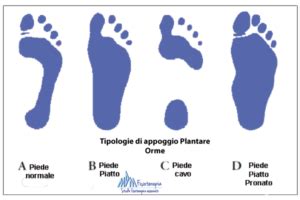 Comparazione tra diverse tipologie di appoggio del piede durante la corsa