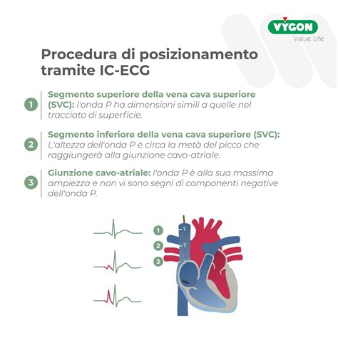 Immagine di un medico che utilizza un ecografo per guidare il posizionamento di un catetere venoso centrale