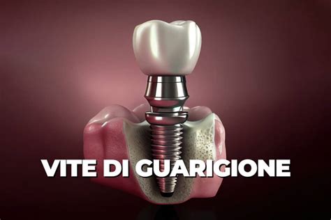 Impianti con viti di guarigione