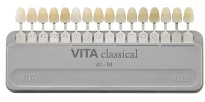 Determinazione della tonalità del composito in resina mediante una scala colori