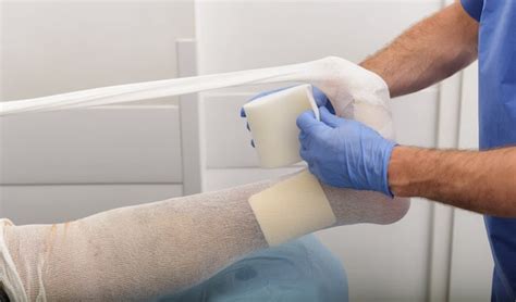 Fasi di applicazione di un gesso ortopedico