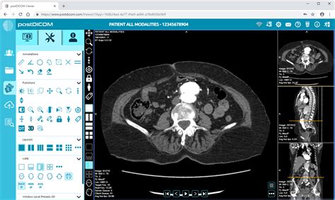 Esempio di immagine DICOM su software dedicato