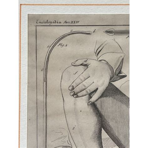 Illustrazione medica storica