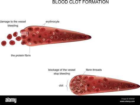 Diagramma della formazione di un coagulo di sangue