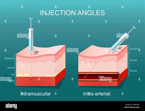 Illustrazione comparativa tra iniezione con ago e iniezione senza ago