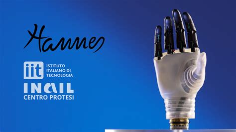 Hannes, la mano robotica premiata
