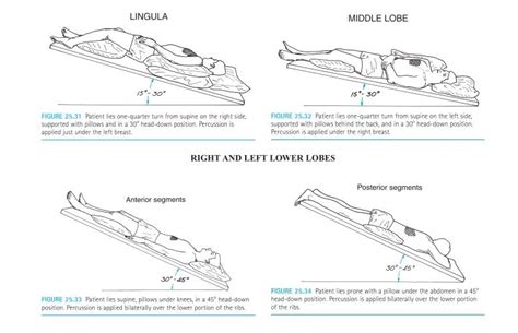 Illustrazione di una persona che esegue il drenaggio posturale