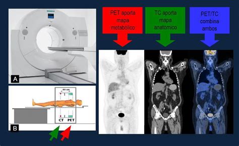 PET in oncologia