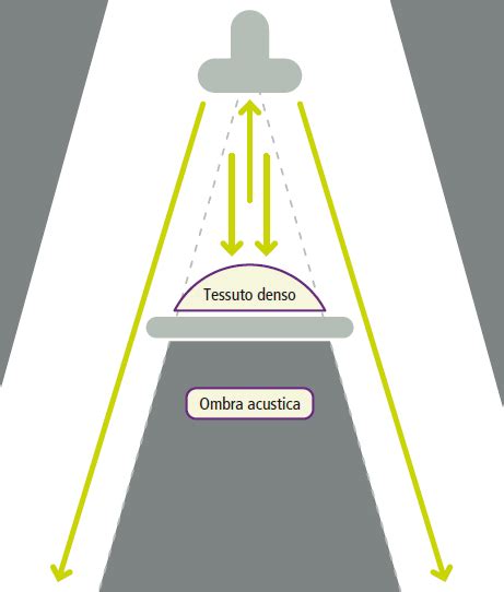 schema tecnologico di funzionamento di un sistema radar per Adaptive Cruise Control su autostrada