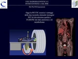 Schema che illustra la fusione delle immagini PET e TC