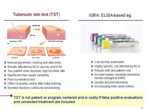 Schema comparativo tra Test Cutaneo Tubercolinico (TST) e Test IGRA