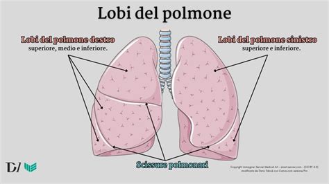 Diagramma del polmone che mostra la localizzazione di un amartoma