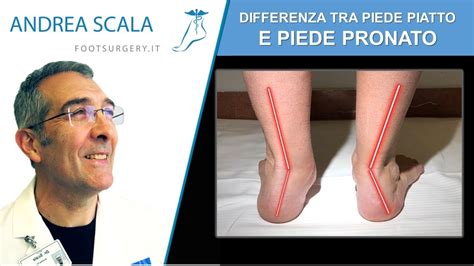 Differenze tra piedi poppieri con e senza prolunga