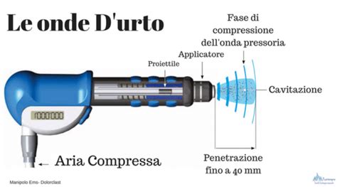 onde d'urto in presa d'aria supersonica