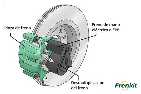 Freno a mano elettrico (EPB) in azione su una pinza freno