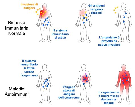Schema del sistema immunitario e delle malattie autoimmuni