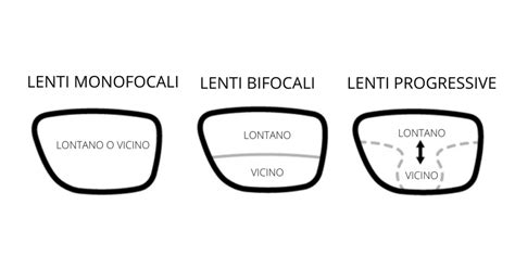 Diagramma che illustra la differenza tra lenti singola visione, bifocali e progressive