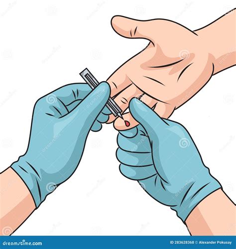 Illustrazione del prelievo di sangue per esami di laboratorio