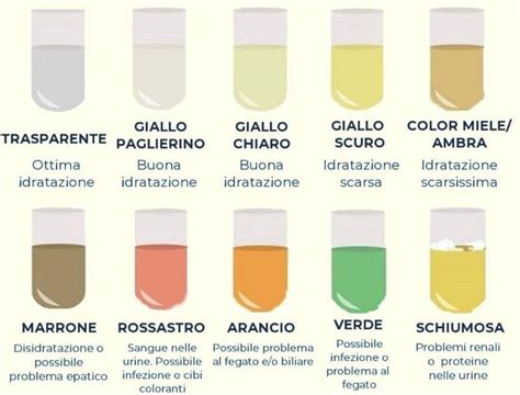 Analisi microscopica del muco nelle urine
