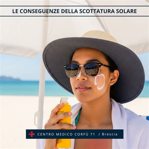 Consulto medico per scottatura solare grave