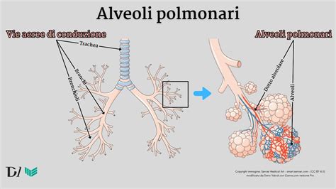 Polmoni e albero bronchiale in un paziente asmatico