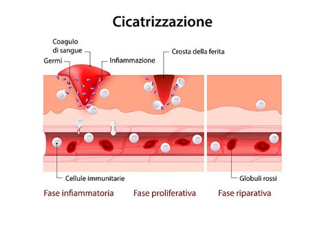 Rimedi naturali per la guarigione delle ferite
