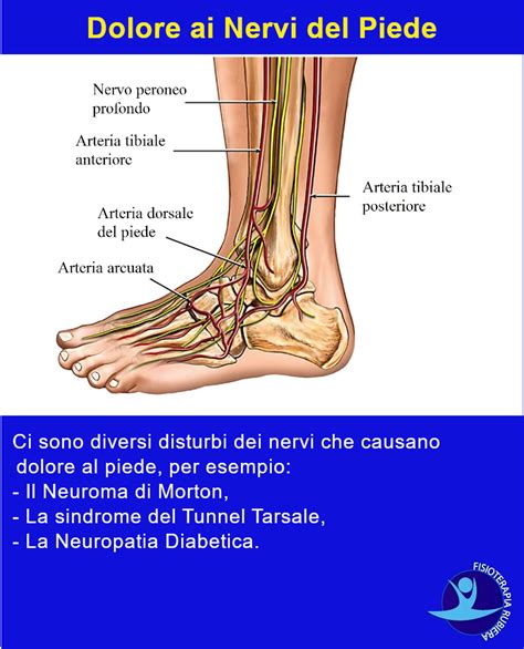 Piede diabetico e nervi danneggiati